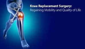 Knee replacement surgeons in India