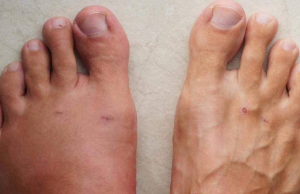 A Month Before a Heart Attack, Your Body Will Warn You of These 7 Signs!!!