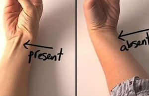 If a Tendon Raises Up When You Touch: Understanding the Phenomenon