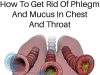 What Is Phlegm and Why Does It Accumulate?