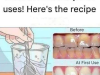 Remove Tartar from Your Teeth and Whiten Them with These Simple Recipes