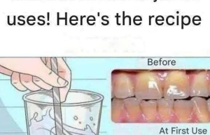 Remove Tartar from Your Teeth and Whiten Them with These Simple Recipes