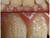 Be careful!! This is what your teeth will become when you eat…