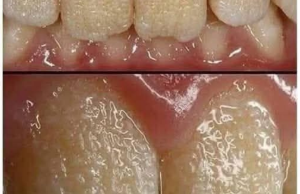 Be careful!! This is what your teeth will become when you eat…