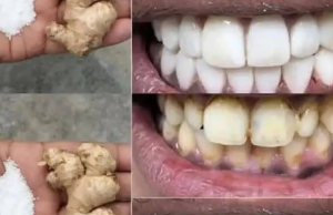Naturally Whiten Your Teeth in Just a Few Minutes with Ginger & Salt: A Powerful At-Home Remedy