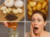 Mixing Garlic and Honey with Cloves: The Secret No One Will Ever Tell You