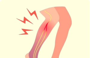 5 Surprising Causes of Weak Legs in Seniors—and How to Fix Them!