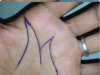 Why Some People Have an ‘M’ on Their Palm: The Mystery Behind This Rare Marking