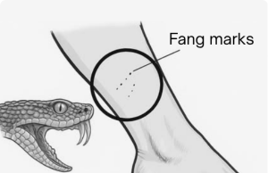 What to Do If You Are Bitten by a Snake and Help Can’t Arrive: Doctor’s Advice