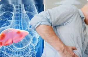 5 Types of Drinks That Harm the Liver Faster Than Alc.ohol — And You Might Be Drinking Them Every Day