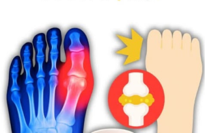 The #1 Drink to Reverse High Uric Acid and Gout — Backed by Science