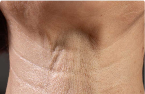 If Your Neck Is Starting to Sag, Don’t Ignore It — Here’s Why It Happens and What You Can Do