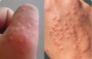 Don’t Overlook These Small Red Spots on Your Arm — They Could Be Important Warning Signs