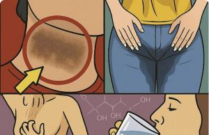 8 Signs You Have Too Much Sugar in Your Body (And What to Do About It)