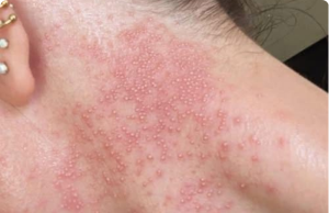 These Are the Consequences of Eating Fast Food Every Day