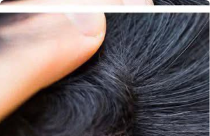 Just Discovered This in My Son’s Hair — What Is It? Should We Go to the Doctor?