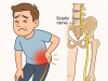 How to Cure Sciatic Nerve Pain: A Guide to Natural Remedies