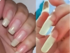 What It Really Means If Your Fingernails Grow Fast