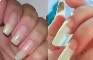What It Really Means If Your Fingernails Grow Fast