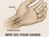 Why Do Your Hands Fall Asleep? Common Causes and Effective Natural Remedies