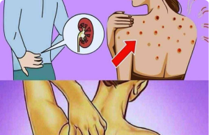 10 Warning Signs Your Kidneys May Be in Danger — And What to Do About It
