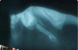 Experts Are Shedding Light on the ‘Death Rattle’ Phenomenon Before Passing