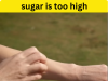 Symptoms of Excess Sugar in the Human Body: How to Recognize the Hidden Warning Signs