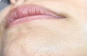 What Chin Whiskers Could Be Telling You About Your Health