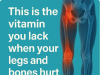 Vitamin Deficiency and Leg or Bone Pain: What You Need to Know