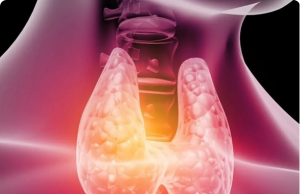 6 Types of Foods That Negatively Affect Your Thyroid — What to Limit or Avoid