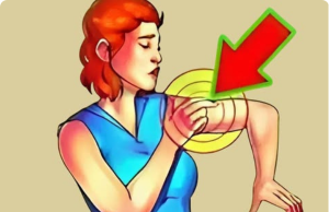 Mini Stroke in People Over 40: What You Need to Know