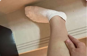 12 Signs of Low Blood Sugar (Hypoglycemia) — Know the Warning Signs Before It’s Too Late