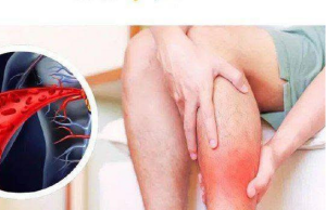 After 50, This Vitamin Can Save Your Legs — The Truth About Niacin (Vitamin B3) and Circulation