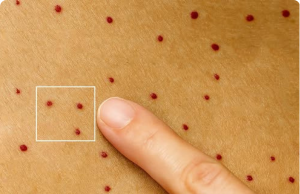 11 Shocking Causes of Red Dots on Your Skin (and When to Panic vs. Relax)