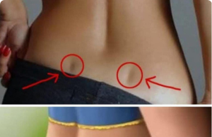 If You Have These Two Holes in Your Back, It Means You Don’t… Need to Worry! (The Truth About “Venus Dimples”)