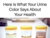What Your Urine Color Really Says About Your Health — A Doctor’s No-BS Guide