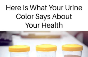 What Your Urine Color Really Says About Your Health — A Doctor’s No-BS Guide