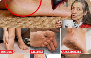 Your Feet Are Screaming for Help: 6 Silent Warning Signs That Could Save Your Life