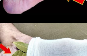 Bay Leaves for Foot Pain: The Viral “Remedy” That’s Actually a Dangerous Myth (And What Really Works)