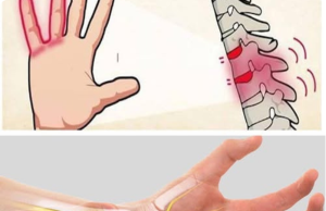 Numb Hand: The Viral “Pinched Nerve” Myth That’s Actually Causing Permanent Nerve Damage (And What Really Causes That Tingling)