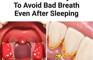 Bad Breath Isn’t About Mint—It’s About This Bacterial War (And Why Your Toothpaste Is Making It Worse)