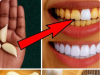 Garlic for Teeth Whitening: The Viral “Natural Hack”