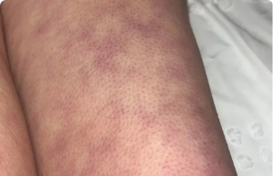 These are the consequences of sleeping with the…