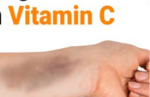Your Body’s Silent SOS: 9 Early Warning Signs of Vitamin C Deficiency