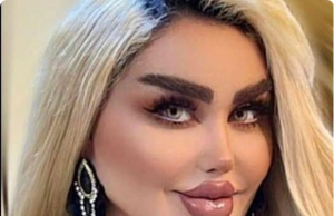 She Had 43 Cosmetic Procedures To Become A Barbie Doll – Critics Say She Looks Like A ‘Zombie’