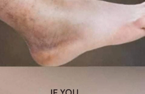 Cleanse Your Colon Naturally — A Gentle Remedy That Works the Same Day