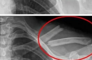 8 Detrimental Effects Soda Can Have On Your Body