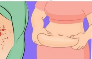 14 Signs Your Blood Sugar Is Way Too High (And 14 Ways to Reduce It)