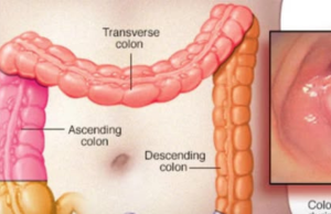 40+ Weird Signs That Lead To a Cancer Diagnosis