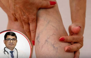 10 Symptoms of Diabetes That May Show Up In Your Feet